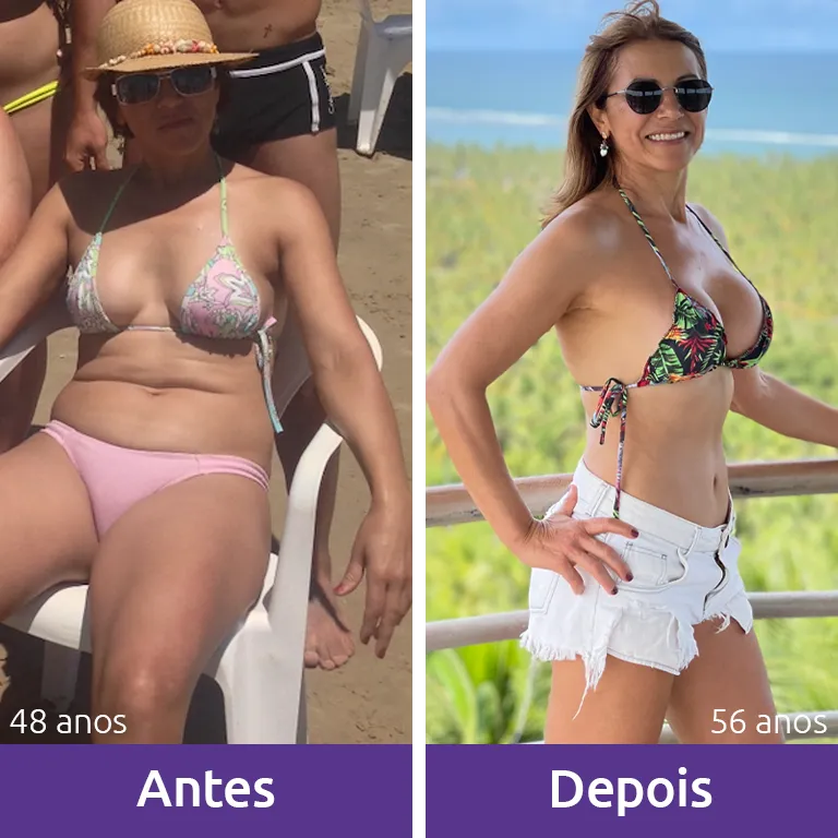 antes e depois